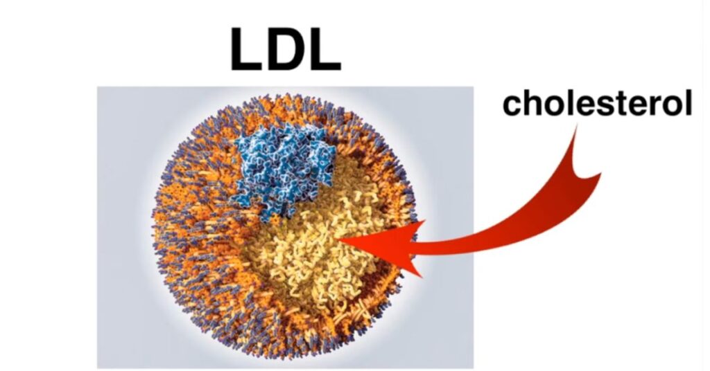 can high cholesterol cause headaches