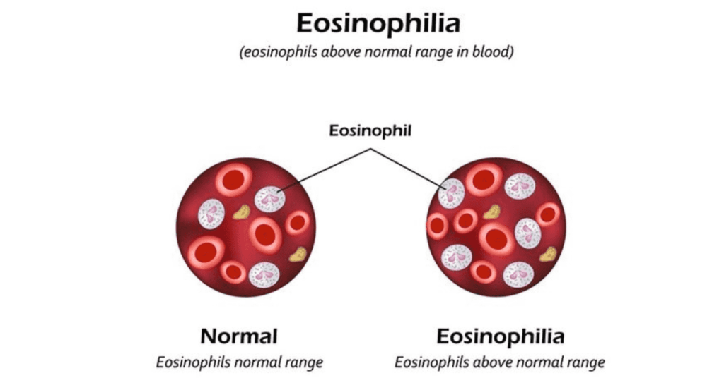 Eosinophils Normal Range 